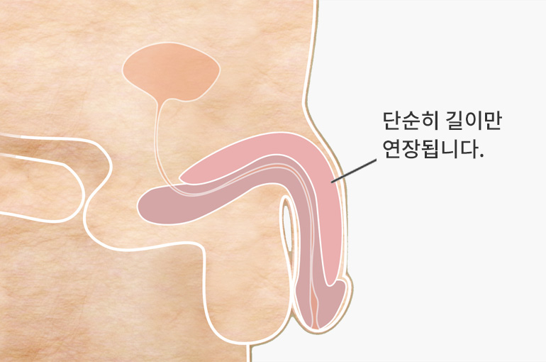 단순히 길이만 연장됩니다.