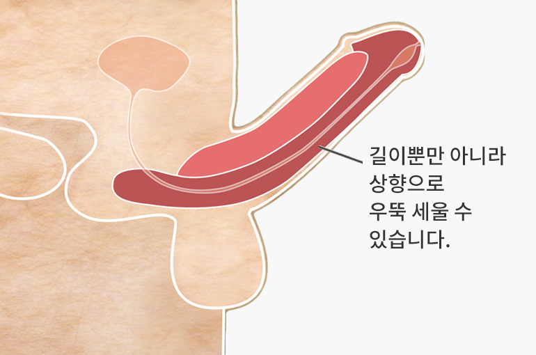 길이뿐만 아니라 상향으로 우뚝 세울 수 있습니다.